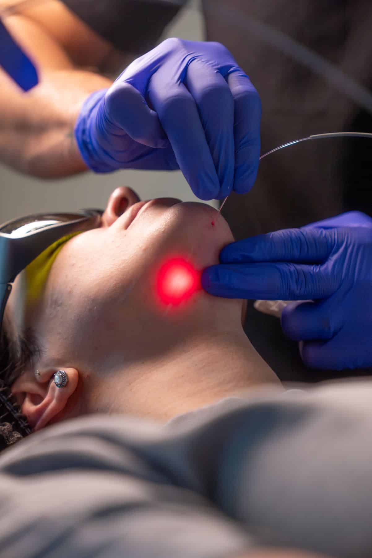 Laser & Hair Removal