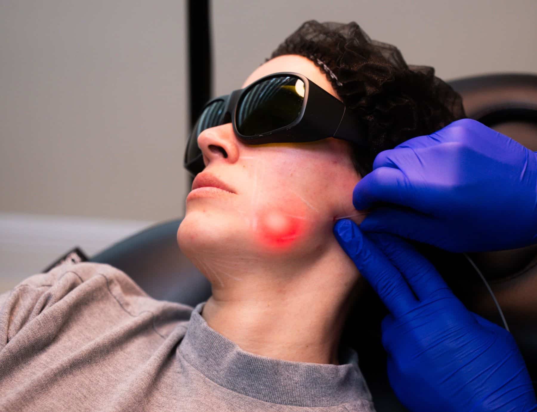Laser & Hair Removal